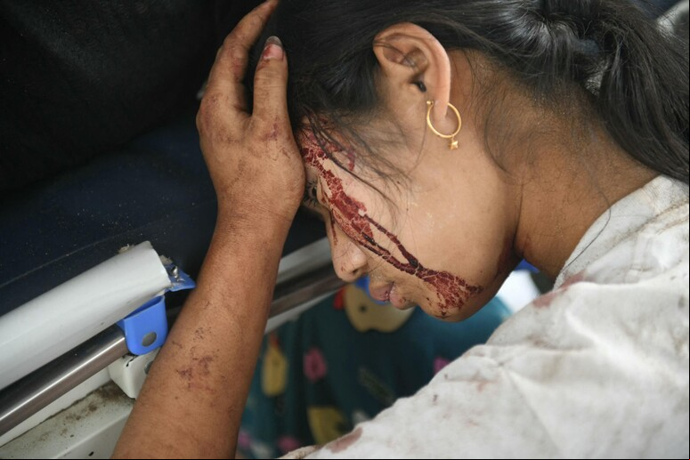 Mulher ferida por terremoto em Naypyidaw, capital de Myanmar © ANSA/AFP